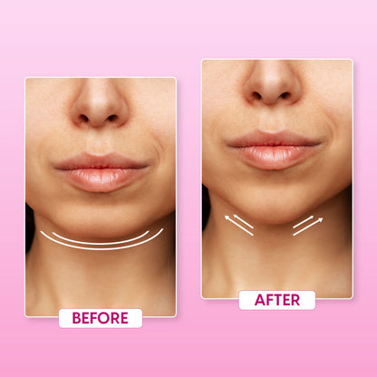 Slimify Face Slimming Strap